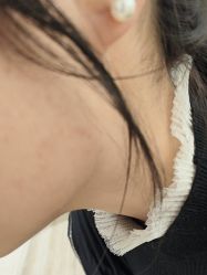 -四川米兰柏羽医学美容医院