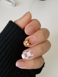 -U-Nail