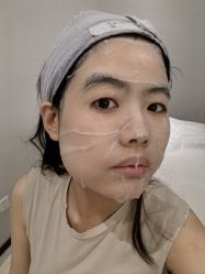 体验后-木兰清颜医疗美容