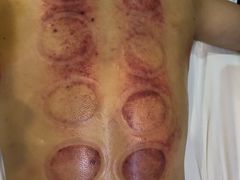 -莱蔻·圣灸堂·推拿艾灸(天山店)