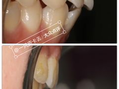 -同步齿科·数字化正畸种植口腔中心(珠海店)