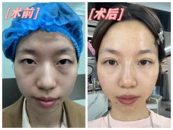 -素美医疗美容·西南眼鼻整形·修复基地