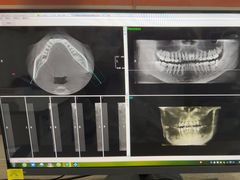 -土豆口腔(凤凰北总店)