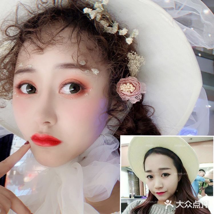 术前山根和鼻头都比较低 两眼间距看起来比较宽