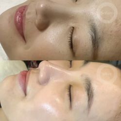 体验前-伊美尔医疗美容医院