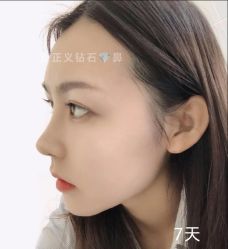 -北京米扬丽格医疗美容·联合丽格鼻整形中心
