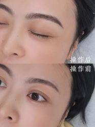点击看大图 -西施无菌半永久纹绣眉眼影唇轻增发纹发际线