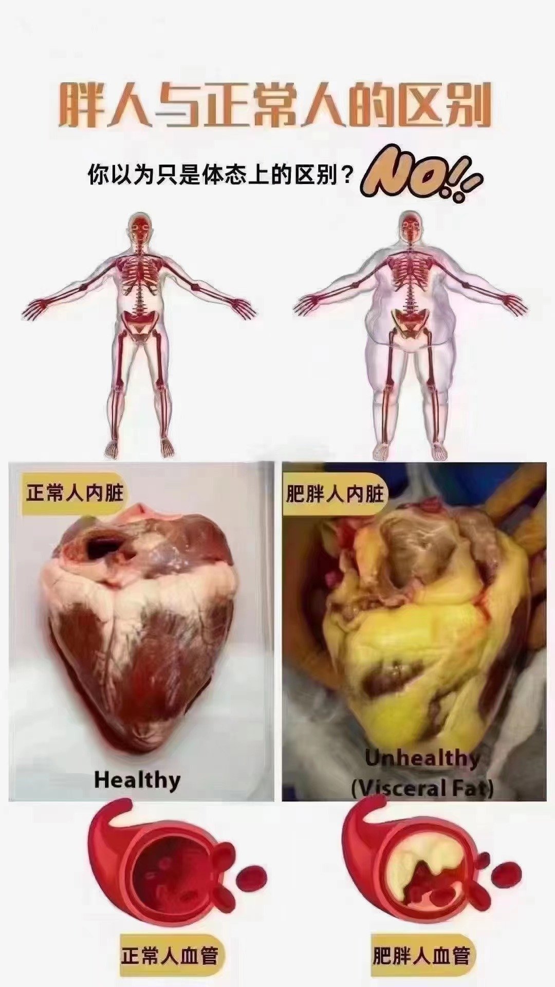 胖人与瘦人的骨骼图片图片