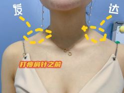 点击看大图 -Yestar宁波艺星整形医院