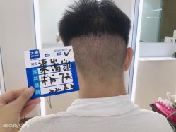 点击看大图 -大麦微针植发丨全国连锁