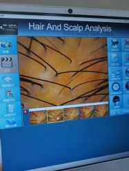 -熙朵美学植发·连锁品牌