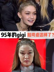 -美莱医学美容医院
