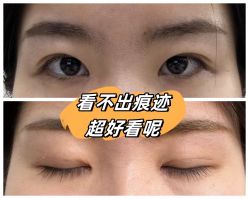 -素美医疗美容·西南眼鼻整形·修复基地