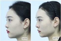 -美莱医学美容医院