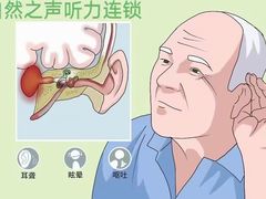 -自然之声助听器·呼吸机(康桥旗舰店)