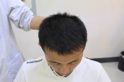 -大麦微针植发丨全国连锁