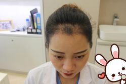 点击看大图 -大麦微针植发丨全国连锁