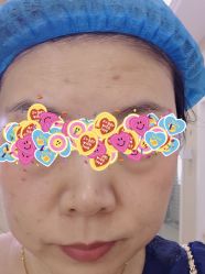 体验前-坤如玛丽·医疗美容中心