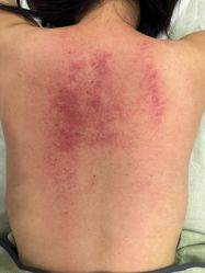 -FUMEIHUI·科技美肤·美体SPA