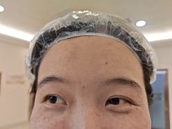 -长沙雅美医疗美容医院