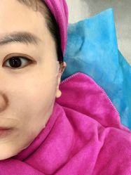 体验后-北京米扬丽格医疗美容·联合丽格鼻整形中心