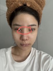 体验后-上海玫瑰医疗美容医院