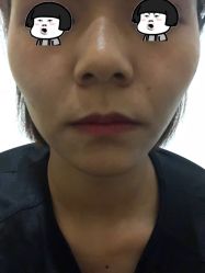 -洁铭新加坡医美