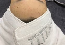 -첫번째 初见美学中心