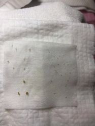 点击看大图 -苑苑vbeauty科技美容SPA