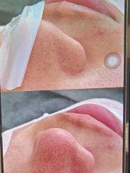 -skin79皮肤管理中心