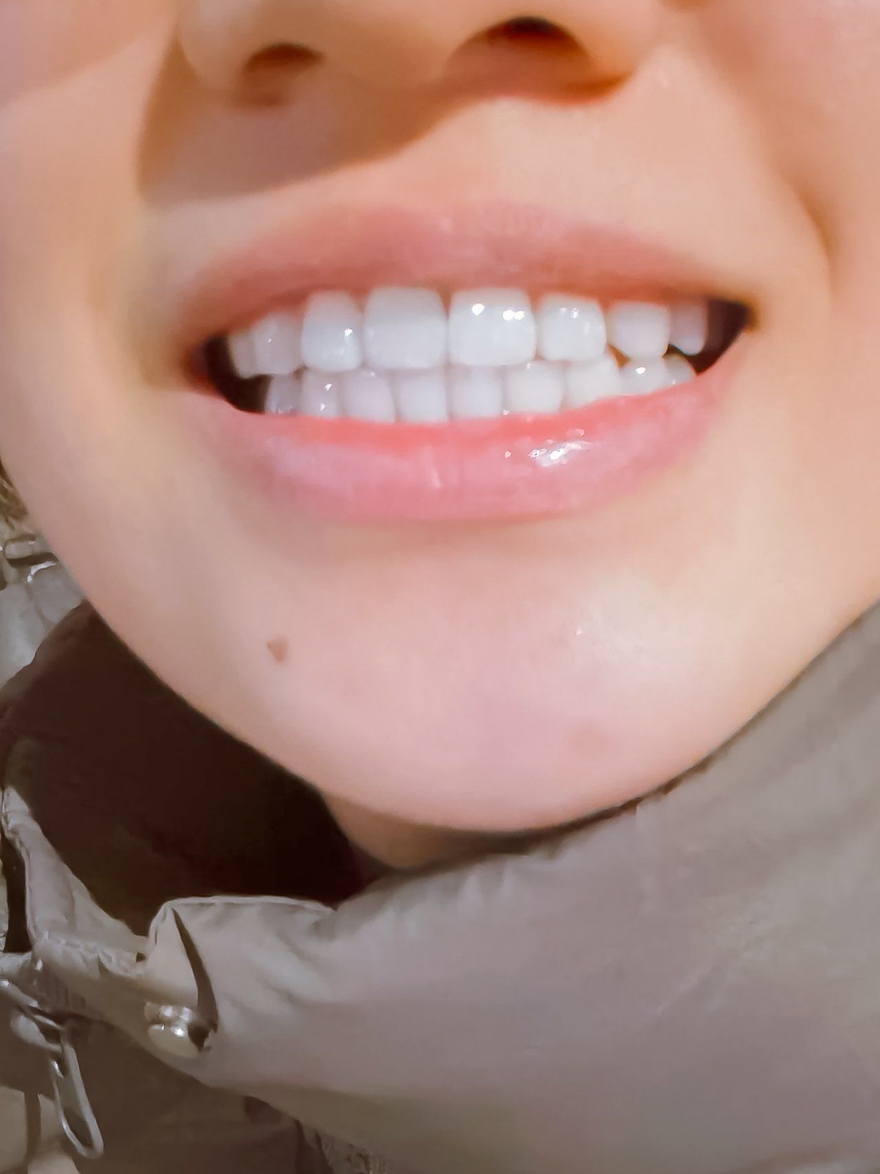 弧度微笑洁白美,我的笑容也变得甜蜜了!