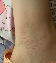 -嘉和医学脱毛中心