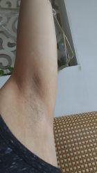 体验后-上海玫瑰医疗美容医院