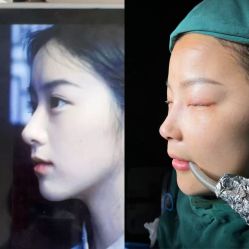 -上海华美医疗美容医院