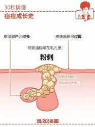 -美肤盾祛痘·问题肌头疗管理中心