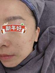 体验前-来美轻医美抗衰中心