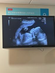 -杭州贝瑞斯美华妇儿医院·早孕·产检·儿科