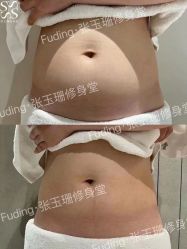 -Fundi张玉珊修身堂·indiba·BTL科技瘦身