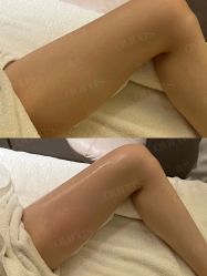 点击看大图 -AURAS璈然科技护肤中心