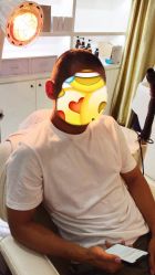 -大麦微针植发全国连锁