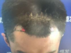 -雍禾植发全国连锁