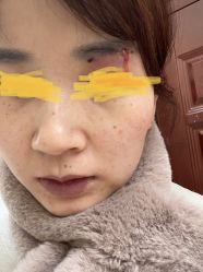 -大华韩艺整形美容医院