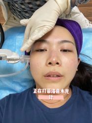-Yestar宁波艺星整形医院