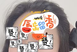 -大麦微针植发全国连锁