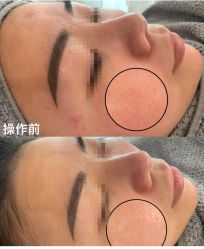 点击看大图 -SKIN79皮肤管理中心