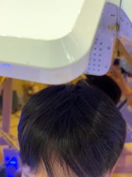 -碧莲盛·不剃发植发