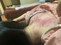 -沐善人家中医·推拿·理疗·三伏灸(新洲店)