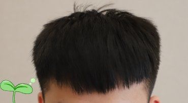 -大麦微针植发丨全国连锁