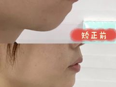 -极光口腔·矫正种植修复(锦江店)