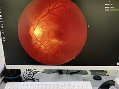 -宝岛眼镜(苏州浒关店)